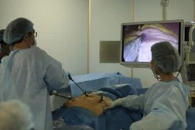 Хирургтар артық салмақпен күресуге қалай көмектеседі - фото 7