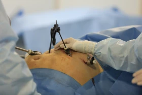 Хирургтар артық салмақпен күресуге қалай көмектеседі - фото 8