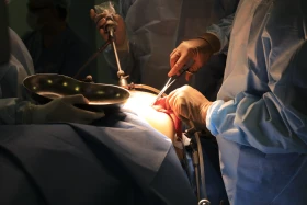 Хирургтар артық салмақпен күресуге қалай көмектеседі - фото 10